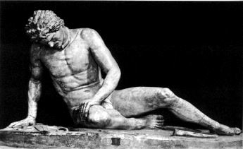 Dying Gaul